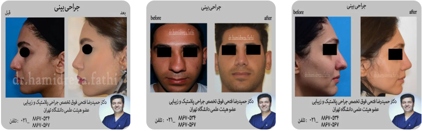 راهنمای جامع جراحی‌های زیبایی: از جراحی بینی تا پروتز سینه و لیفت صورت
